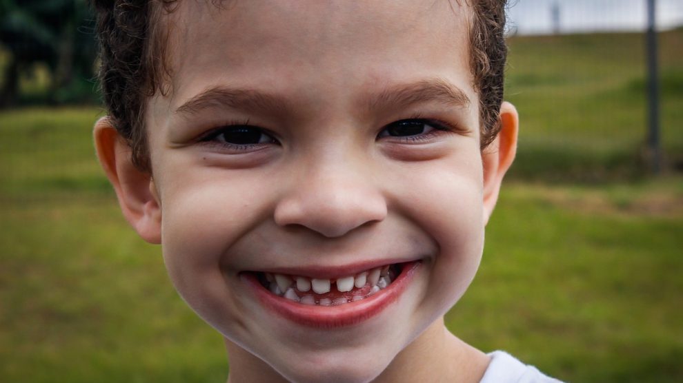 why kids have crooked teeth